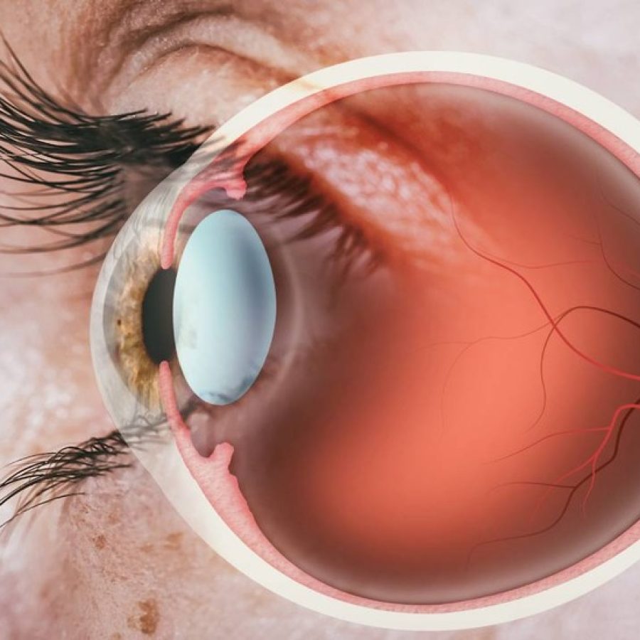 ocular